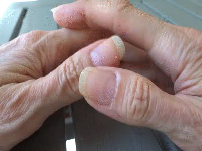 27630 - Only long natural fingernails